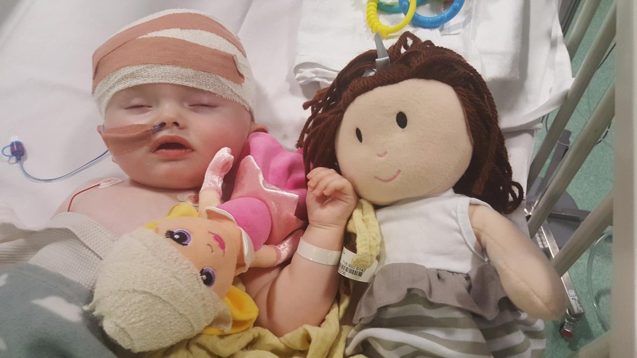 Baby Ellie's head is bandaged after her operation
